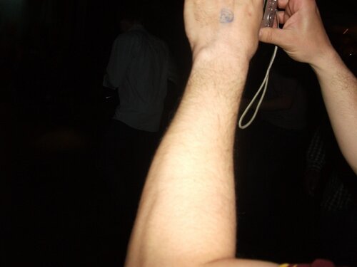 rob's arm